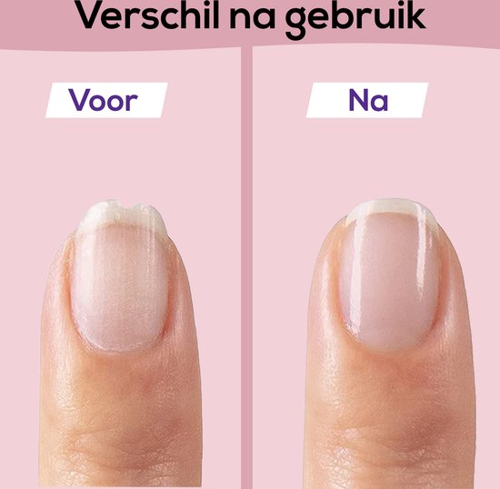 SafeCare Baby Nagelfeilen-Set – Elektrisch, Sicher und Geräuschlos für Babys